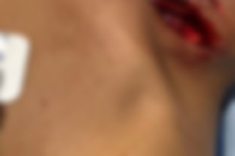 Idosa fica raivosa após namorado novinho recusar sexo no mercado e o ataca com navalha